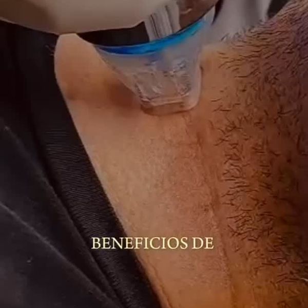 Reel: beneficios de un tratamiento con aparatología en cuello